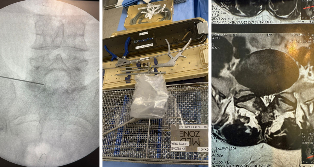 Sofre de espondiloartrose lombar? Saiba o que fazer. Sofre de espondiloartrose lombar? Saiba o que fazer.