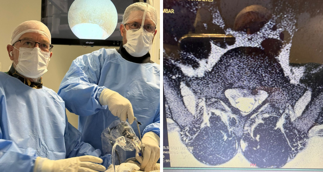 Descubra como a descompressão endoscópica lombar pode aliviar a dor