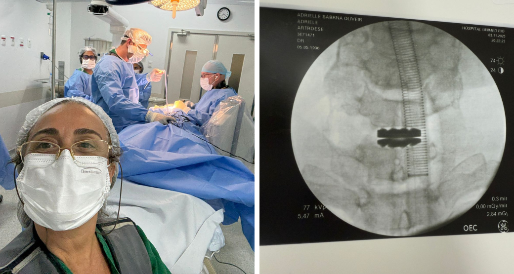 Artroplastia discal cervical: Uma abordagem cirúrgica para a doença discal