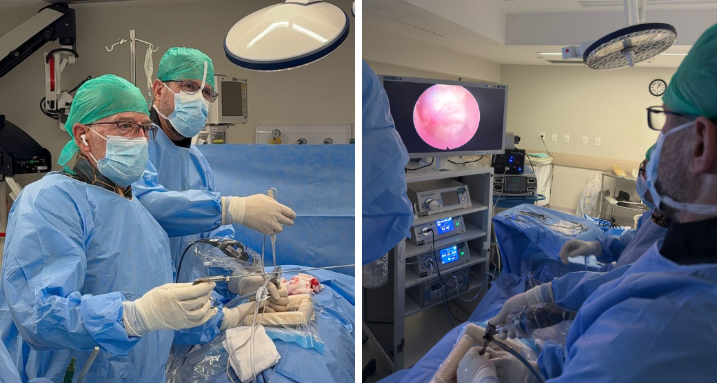 Alívio para a dor radicular: descompressão endoscópica por via interlaminar