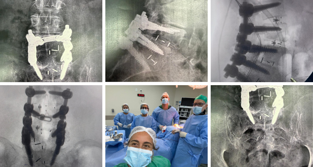 Desvendando a Artropatia degenerativa. O que é e como tratar?