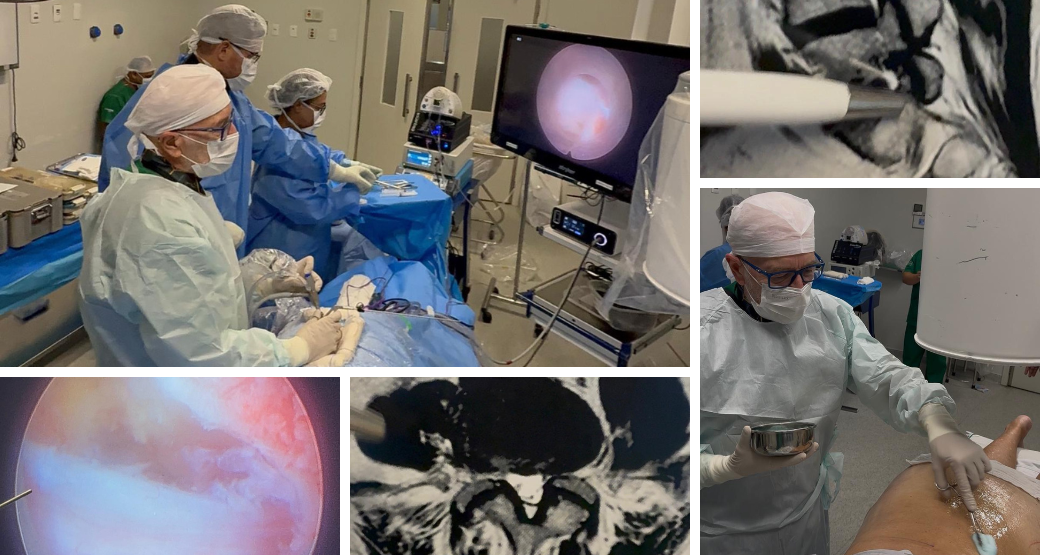 Estenose lombar: Saiba como aliviar os sintomas e recuperar a mobilidade