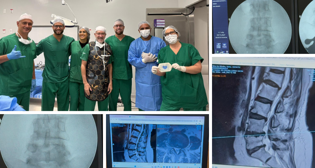 Cirurgia endoscópica permite descompressão radicular