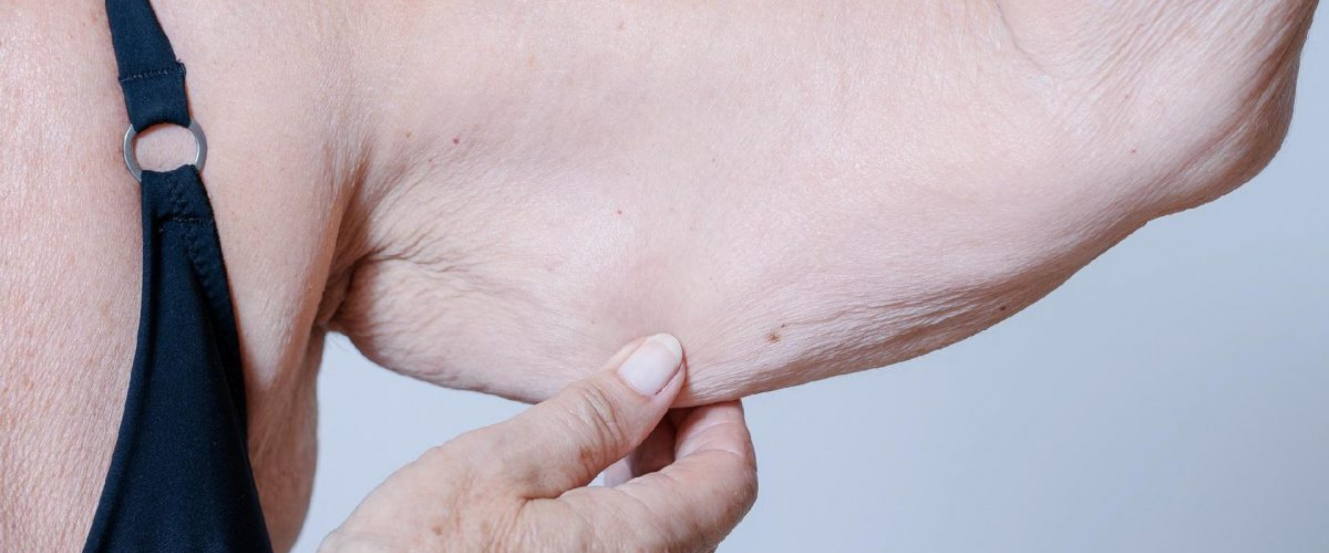 Sarcopenia